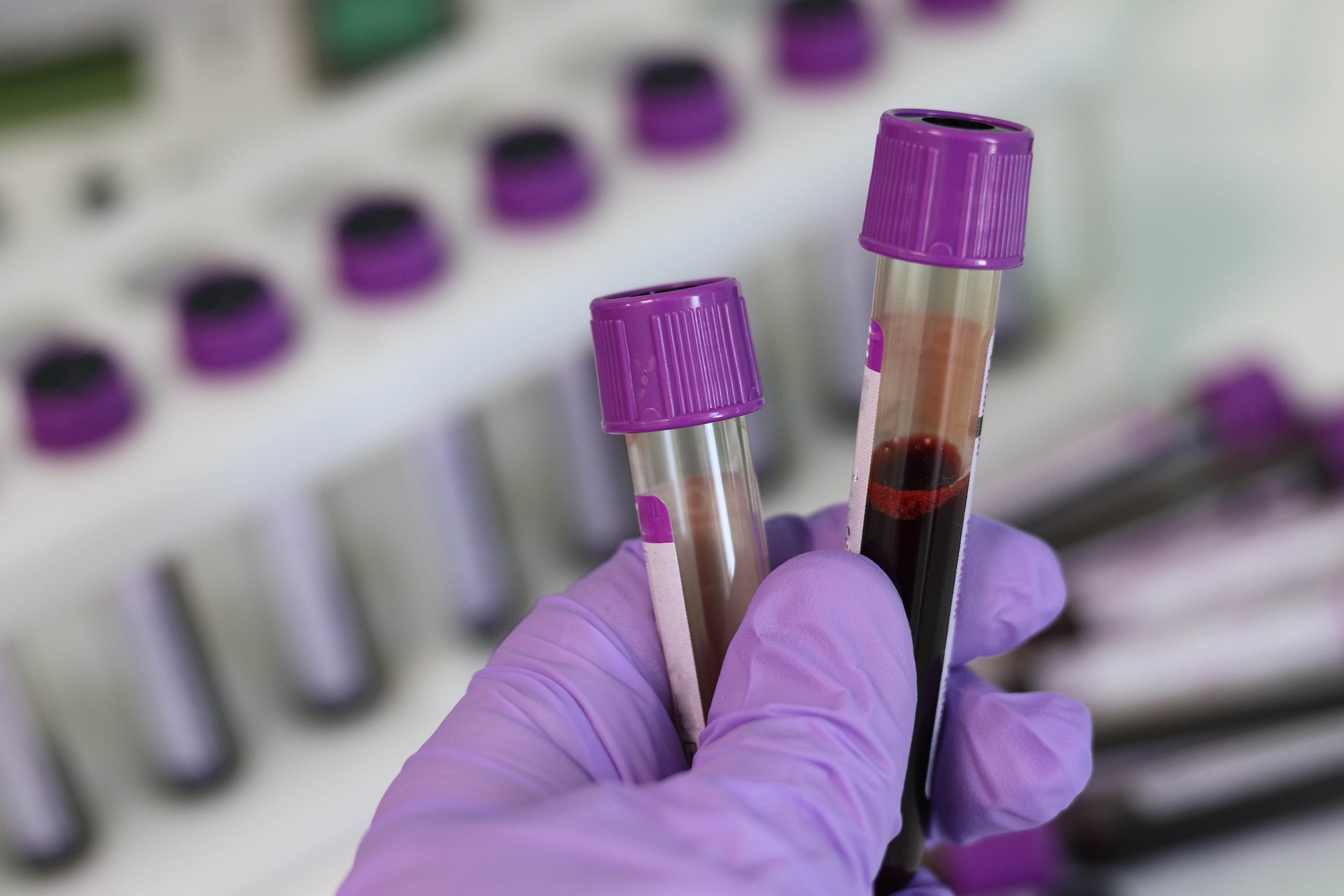 What Routine Blood Tests Does Medicare Cover