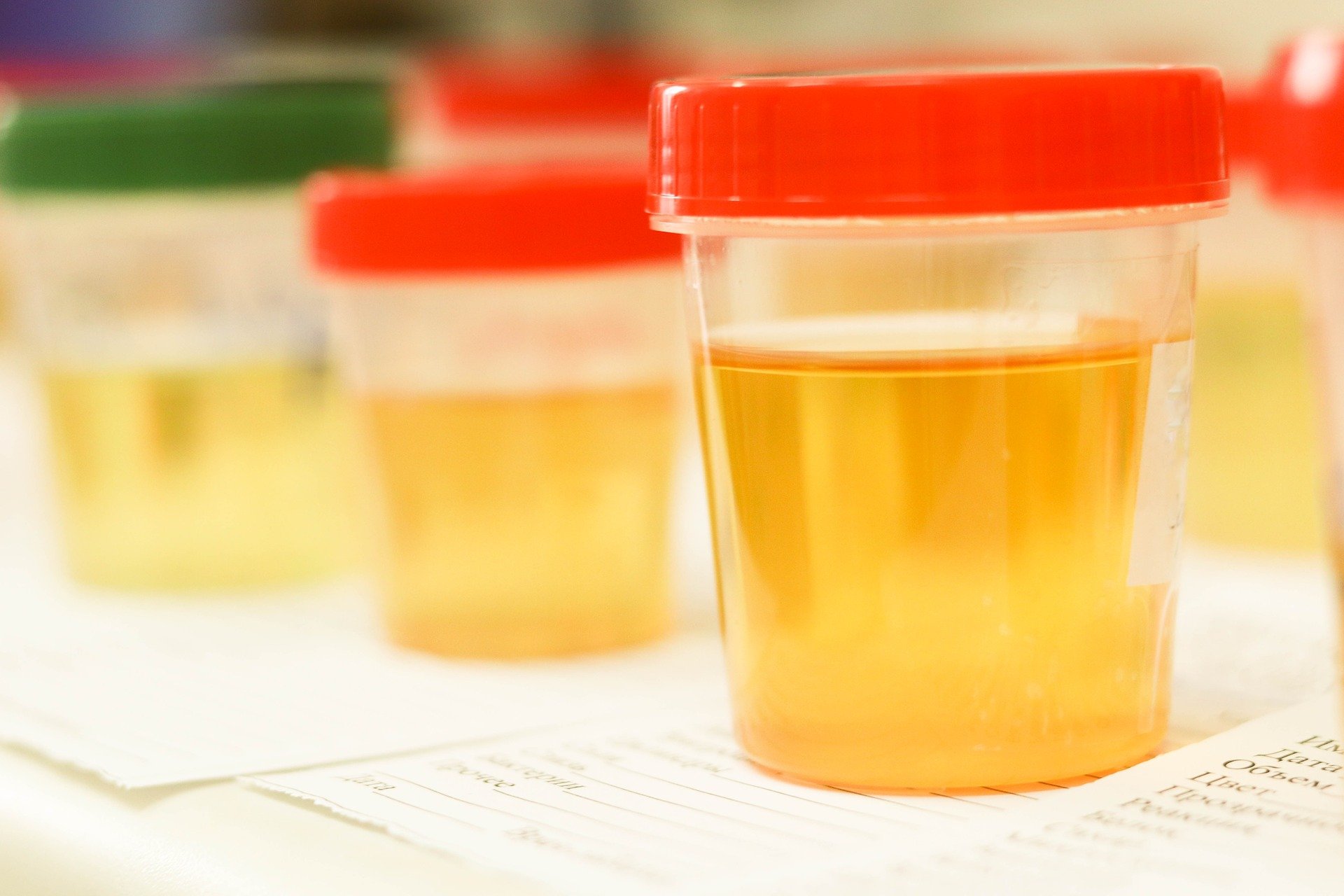 Types Of Urine Tests Lab Testing Api 7711